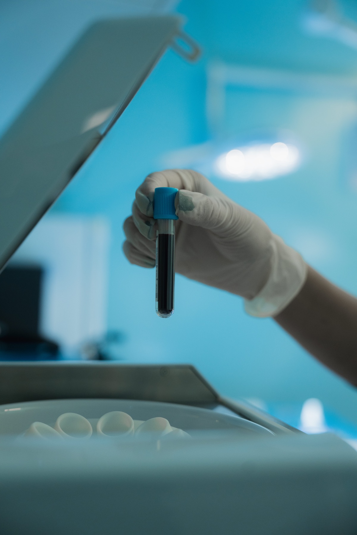 Provetta per PRP accanto alla centrifuga presso LDF Hair Clinic